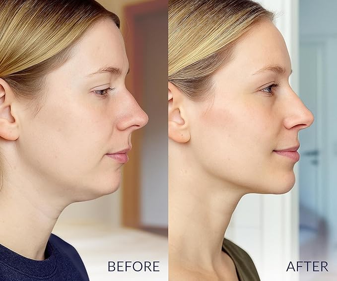 Stylia V Line Lifting Collagen Mask - Lift, Firm & Contour Jawline - Tightening Double Chin Strap with Hyaluronic Acid & Aloe - Neck Lift & Face Tightening Mask - Jawline Shaper Face Lift Tape (2PC)