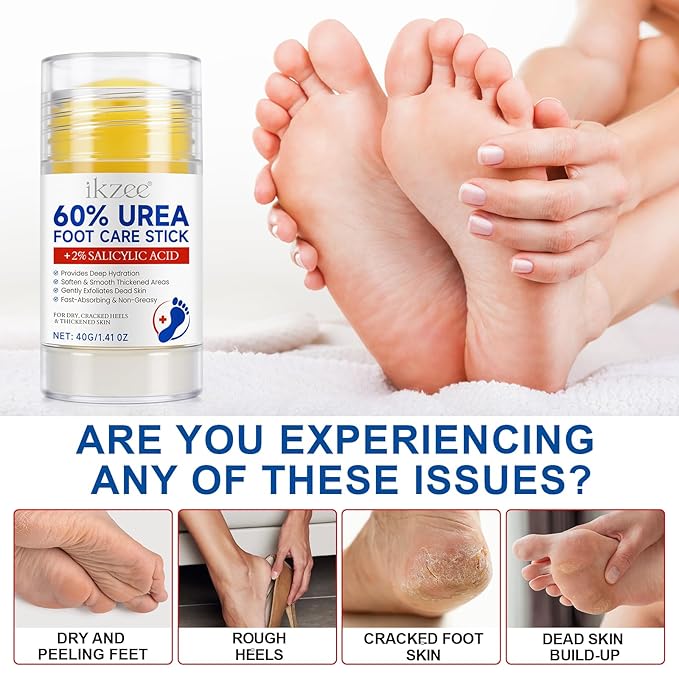 2PCS Urea Cream Stick 60% plus 2% Salicylic Acid, Urea Foot Cream for Dry Cracked Heels, Foot Lotion Stick for Rough Thick Dry & Cracked Skin, Maximum Strength Moisturizer,Foot Moisturiser