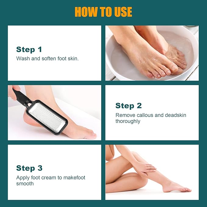 Foot Rasp Foot File, 2 Pcs Stainless Steel Pedicure Callus Remover for Feet, Professional Foot Care Tools for Pedicure to Removes Hard Skin Corns for Dry and Wet Feet