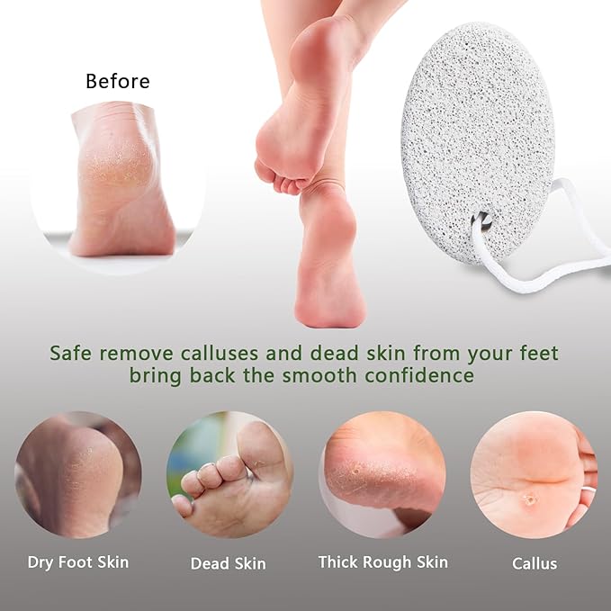 8-Pack Foot Pumice Stone for Feet, Borogo Natural Lava Pedicure Tools Hard Skin Callus Remover for Feet and Hands