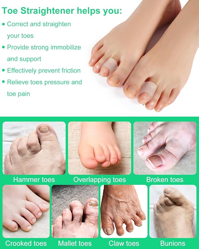 10Pcs Hammer Toe Corrector Straighteners, Bunion Spacer Separators for Women and Men Curled Toes, Crooked, Claw, Hammertoe, Gel Toe Splints for Straightening (Medium)
