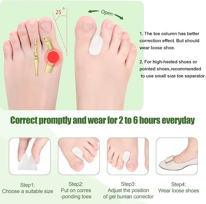 FOYOLO Gel Toe Separators and Flared Bunion Spacers 8PCS Temporary Bunion Corrector,Toes Splint Gel Toe Spacers for Overlapping Toe and Curled Toes,Stay in Place-(2 Small & 6 Large Size-Clear)
