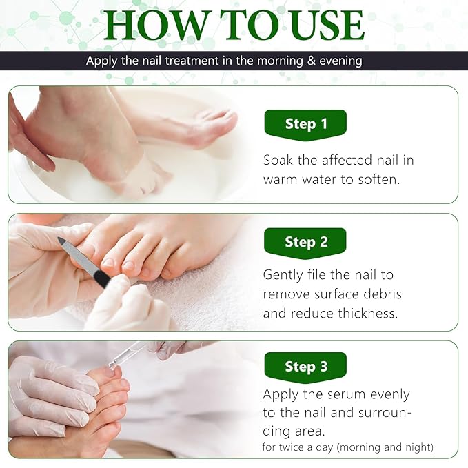 7 Days Nail Fungus Treatment Extra Strength, Toe Nail Growth Oil, Ginger Nail Growth Serum, Foot Toenail Serum for Brittle Thin Damaged Nails Strengther and Growth, Repairs Cuticles - 2 Pcs 1 Pack