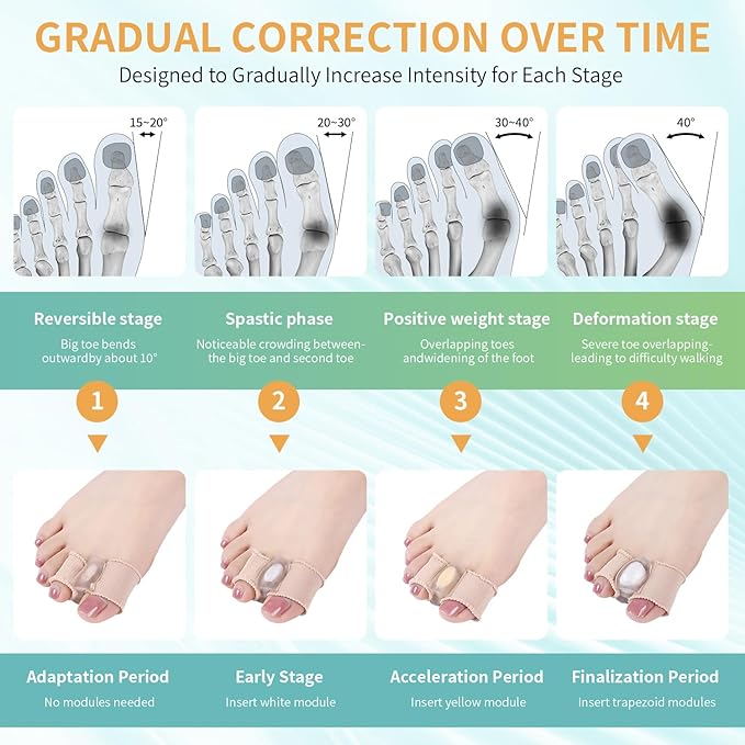 Adjustable Big Toe Separators for Women & Men Bunion Corrector & Hammer Toes Straightener, Silicone Spacers for Overlapping Toes, Corn Relief & Foot Pain Support, Soft Gel Protectors