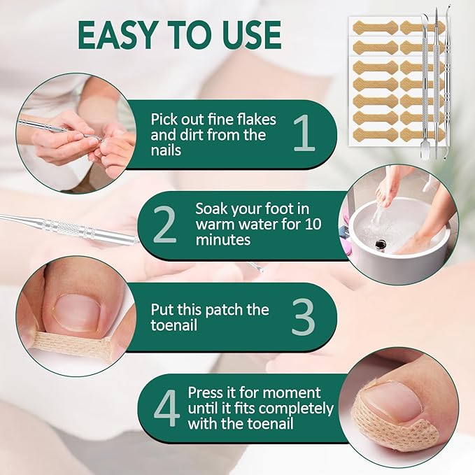 100pcs Ingrown Toenail Treatment, Breathable Ingrown Toenail Strips Ingrown Toenail Stickers, Toenail Corrector Patch with 3 Pedicure Tools for Ingrown Toenail