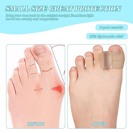 6PCS Gel Toe Spacers for Men and Women, Bunion Toe Separators for Overlap Toes, Bunions, Big Toe Alignment, Corrector and Spacer, Portable & Comfortable