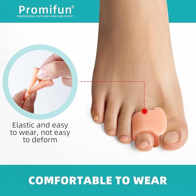 Toe Separators for Women Gel Toe Separators for Overlapping Toes, Bunions, Big Toe Alignment, Corrector and Spacer, Preventing Rubbing Relieve Pressure (Large, 12 Pack, Beige)