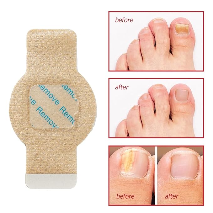 Nail Patches,21 Patch,Nighttime Nail Patches,for Damaged Nails Foot Nails Repair and Care,Strengthens Brittle Nail