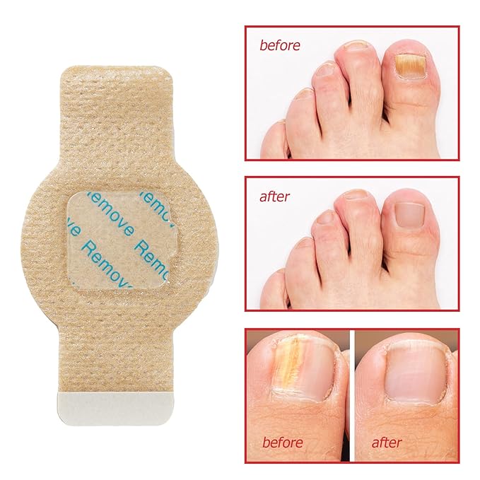 Nail Patches, 21 Pcs Toenail Treatment Extra Strength 8-Hour Overnight Nail Fast Acting Repair for Damaged & Discolored Nails Overnight Renewal Effortless Hydrogel Nail Care for Men and Women
