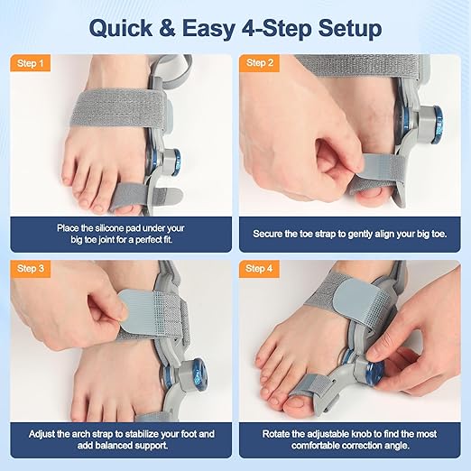 Bunion Corrector for Women Men Big Toe,Adjustable Knob Bunion Corrector for Bunion Relief,Bunion Fix with Bunion Silicone Pad,Suitable for Left and Right Feet(1PCS)