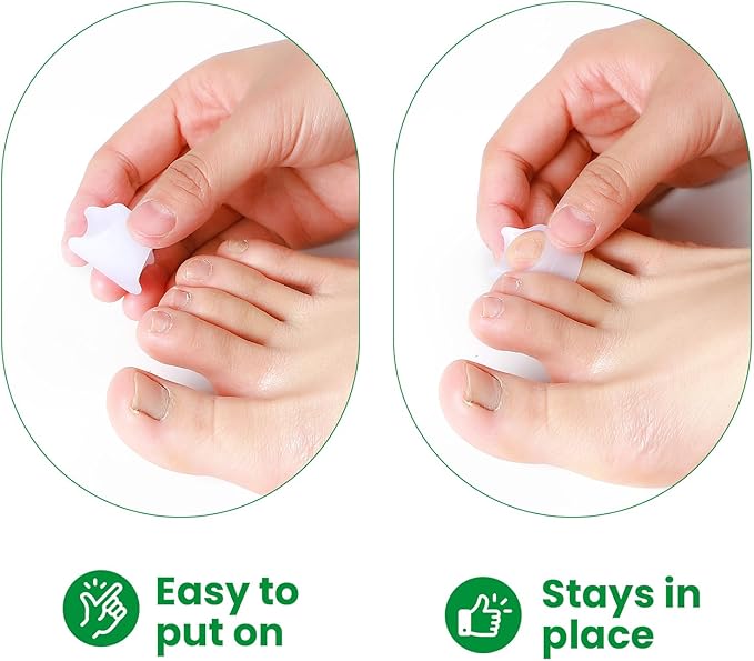 Bukihome Hammertoe Corrector - 6 Pack Toe Splints - Soft Gel Toe Straighteners - Realign Bent, Curled, Crooked, Claw, Hammer Toes - Toe Corrector for Men and Women, Small Sizes (White)