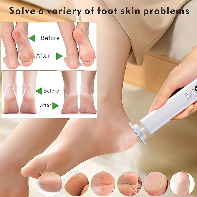 Cordless Electric Foot File Callus Remover - 6-Speed Heel Scraper for Cracked Heels,Painless Dead Skin Remover for feet, Rechargeable Foot Grinder Professional Pedicure Tools Kits for feet (White)