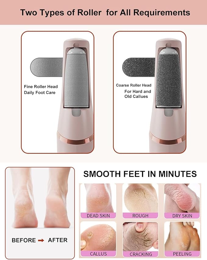 Electric Callus Remover for feet,Rechargeable Foot Callus Remover -2 Speed Adjustable,Coarse & Fine Roller - Electric Hard Skin Removal for Feet-Smooth feet in Seconds for Women & Men (Pink)