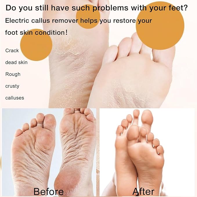 Electric Callus Remover Foot File, 2024 New USB Rechargeable Foot Repair and Grinding Device, Heel Polisher Digital Display, Feet Callus Remover, for Men Women Dry Callus Dead Skin (Blue)