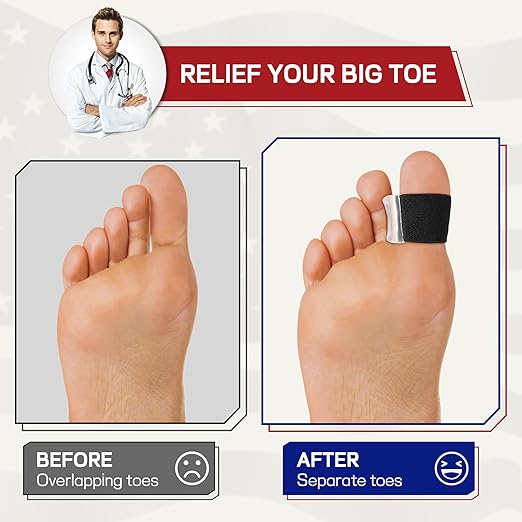 Orthopedic Gel Toe Separators for Overlapping Toes,Big Toe Spacers for Hallux Valgus Corrector with Shock Absorption, All-Day Comfort for Men & Women. (BLACK, WOMEN(7-10)/MEM(5-8.5))