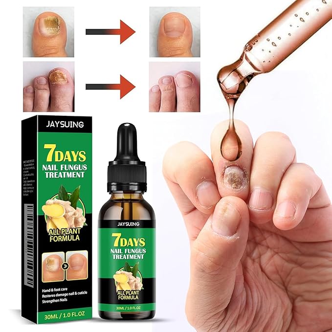 7 Day Nail Treatment, Nail Strengthener and Growth & Oregano Tea Tree Oil for Toenail: Safely and Gently, Daily Maintenance