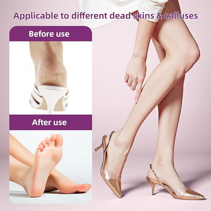Electric Foot Callus Remover: Feet File Callus Remover with 60pcs Sandpaper Discs - Dead Hard Skin Foot Scrubber for Women -3 Adjustable Speed Pedicure Tools for Feet