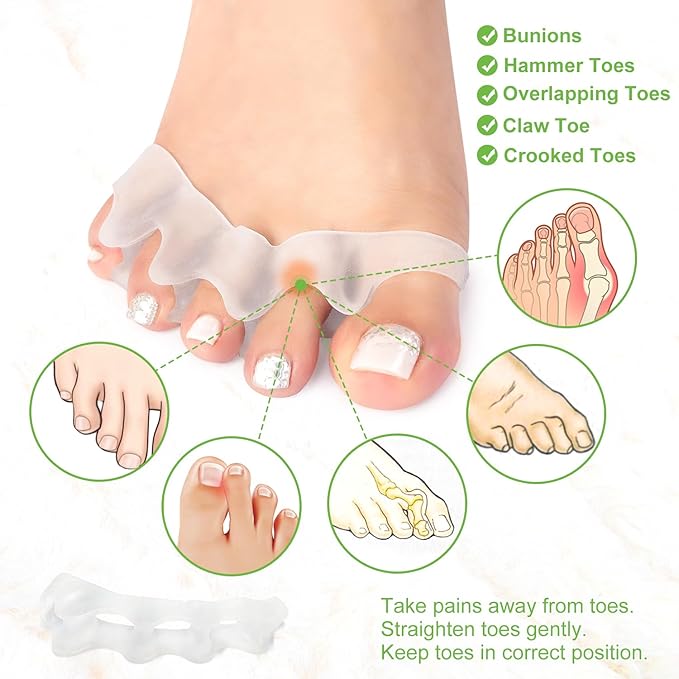 Niupiour Toe Separator for Women and Men, 8 Pack Bunion Corrector for Hammer Toe, Bunions, Silicone Toe Spacers Correctors for Straightening Overlapping Toe, Relieve Bunion Pain