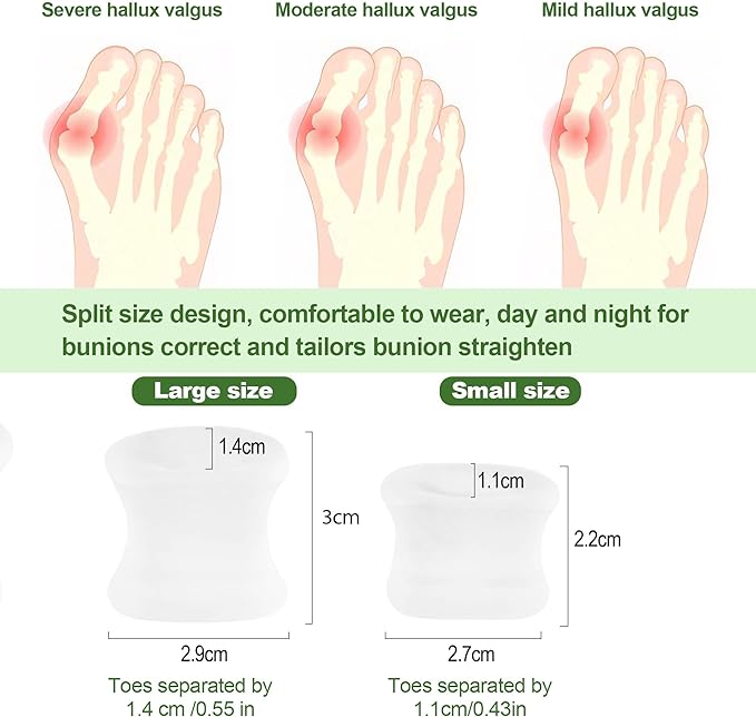 FOYOLO Gel Toe Separators and Flared Bunion Spacers 8PCS Temporary Bunion Corrector,Toes Splint Gel Toe Spacers for Overlapping Toe and Curled Toes,Stay in Place-(2 Small & 6 Large Size-Clear)