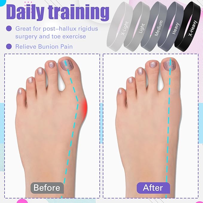 Set of 5 Toe Stretcher Bands for Bunions Correction Foot Big Toe Spacers Resistance Straightener Loop Bands with Carry Bag for Women Men Hallux Valgus Alignment Yoga Exercise(Grey)