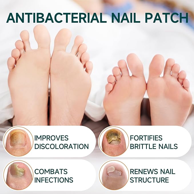 32 Pcs Fungal Nail Patches, Toenail Fungus Treatment Extra Strong Formula, Nail Repair for Damaged Nails, Overnight Renewal for Men and Women