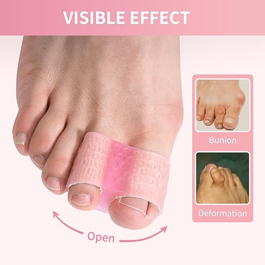Toe Separator for Women and Men, Breathable Gel Bunion Corrector for Big Toe, 4 Pcs Big Toe Spacer for Bunions, Overlaps, Deformed Toes - Pink Small