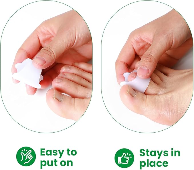 Bukihome Hammertoe Corrector - 6 Pack Toe Splints - Soft Gel Toe Straighteners - Realign Bent, Curled, Crooked, Claw, Hammer Toes - Toe Corrector for Men and Women, Large Sizes (White)