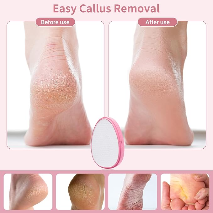 Foot File,Nano Glass Foot File Callus Remover for Feet,Foot Scrubber Dead Skin Remover,Gentle Exfoliation for Your Foot Massage in Shower- Light Pink