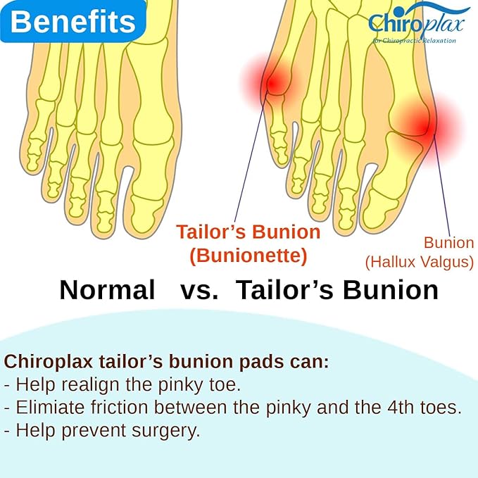 Chiroplax Tailor's Bunion Corrector Pads Bunionette Pain Relief Silicone Pinky Toe Straightener Separator Spacer Sleeve Cushion Splint Protector for Men & Women (4 Pads, Shims - Size Regular)