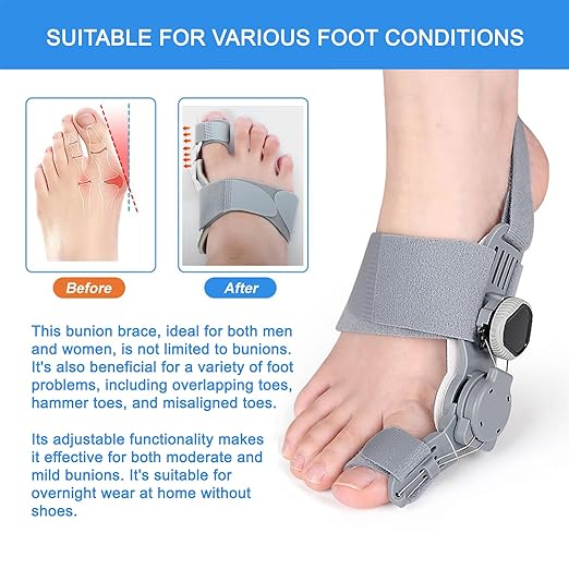 Upgraded Bunion Corrector for Women & Men, Orthopedic Bunions Correction with Non Slip Big Toe Separators, Adjustable Bunion Splint Suitable for Left/Right Foot Bunion Relief