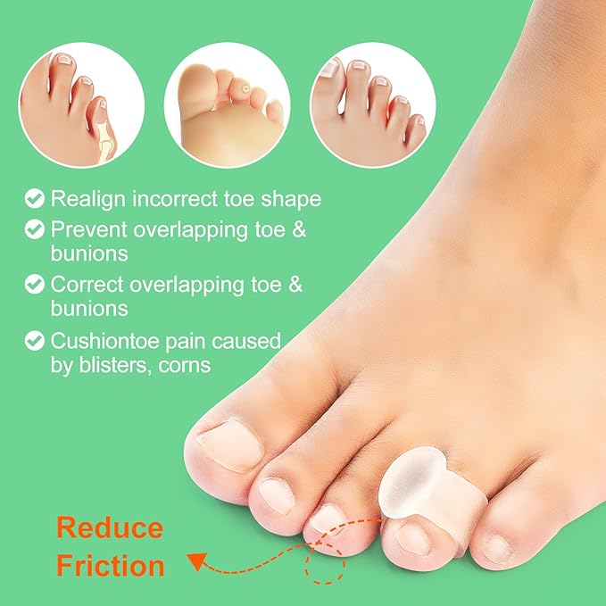 Niupiour Silicone Toe Separator - 14 Pack Gel Toe Spacers for for Women and Men, Toe Corrector for Women and Men, Toe Straightener for Bunions, Overlapping Toe, Hammer Toe, Say Goodbye to Pain