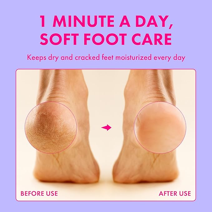 Foot Cream for Long-Lasting Odor Control | Neutralizes Odor at the Source | Hydrates Dry, Cracked Heels for Soft, Healthy Feet | Natural Mushroom Formula