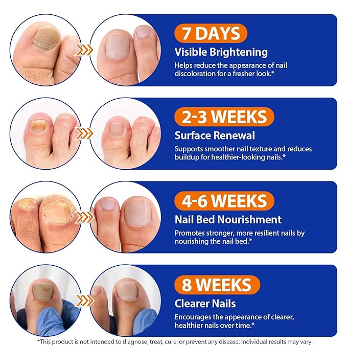 Extra Strength Toenail Treatment - 32 Pcs Nighttime Nail Patches, Overnight Toe Nail Treatments for Damaged Nails Foot Nails Repair and Care, 8-Hour Restores Healthy Appearance