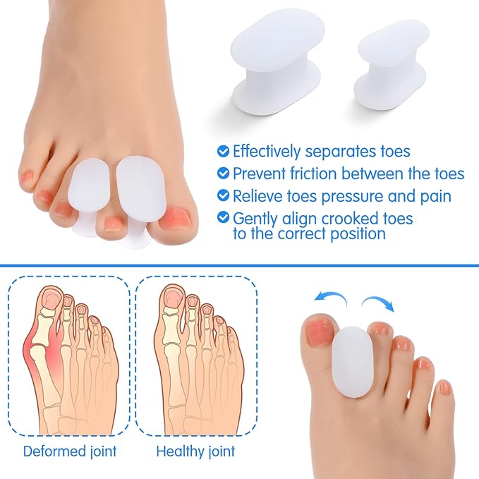12 Pack Soft Gel Toe Separators for Women and Men, White Silicone Toe Spacers, Two Size Separators Toes Straighteners for Crooked Toes, Overlapping, Bunions, Calluses