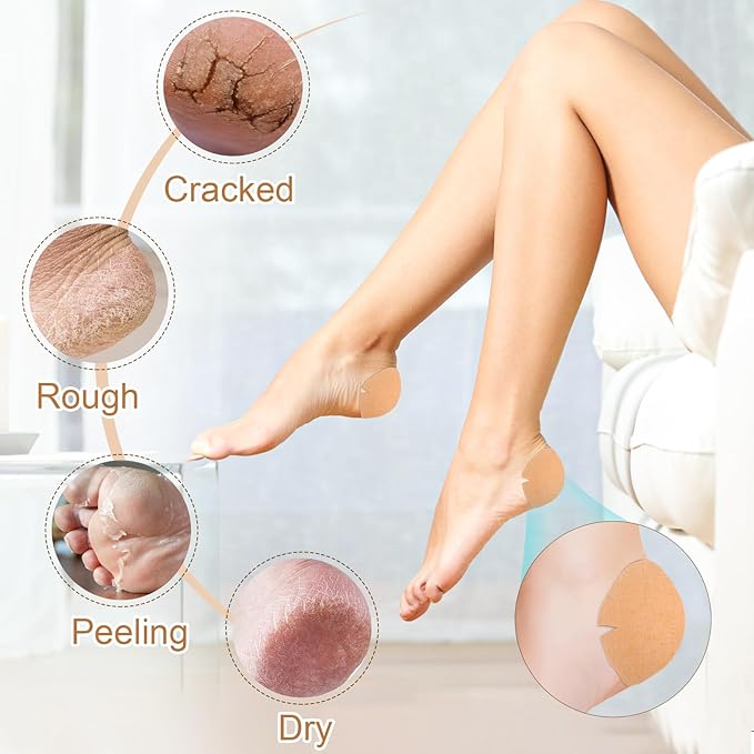 30PCS Patented Cracked Heel Treatment Patches, Cracked Heel Repair Bandage (80mm x 80mm)