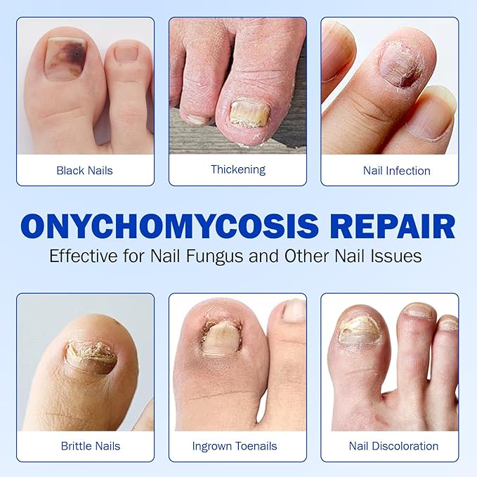 Nail Patches, 42 Pcs Toenail Treatment Extra Strength 8-Hour Overnight Nail Fast Acting Repair for Damaged & Discolored Nails Overnight Renewal Effortless Hydrogel Nail Care for Men and Women