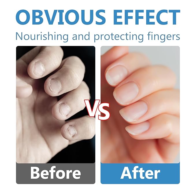 Nail Biting Prevention-Nail Biting Treatment for Kids-Anti-Nail Biting Thumb Cream for Kids-100% Natural Bitter Formula-No Additives-Protects Nails Healthy Nail Growth-Safe for Children, 2.11Fl.Oz