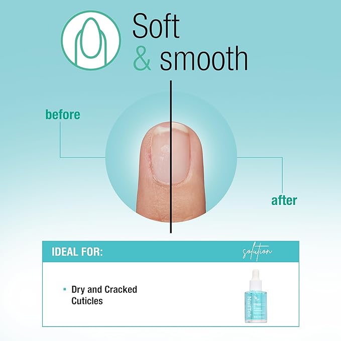 Nail Tek Renew Cuticle Oil – Nourishing & Hydrating Cuticle Treatment, Moisturizing Nail Care, Softens Dry Cracked Cuticles, Promotes Healthy Nails Growth, 0.5 fl oz