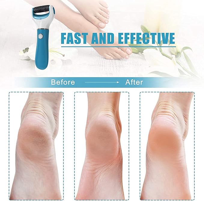 Electric Foot File Callus Remover Professional, 2-Speed Rechargeable Pedicure Tool for Remove Calluses, Dry, Hard, Dead, Cracked Skin, includes 2 Coarses (blue)