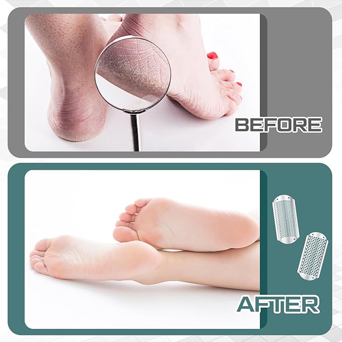 Moxweyeni 8 Pcs Foot File Callus Remover Replacement Blades Metal File Callus Remover Shaver Blades Hard Skin Remove Stainless Steel 2 Designs Big/fine Hole for Detachable Foot Scrubber