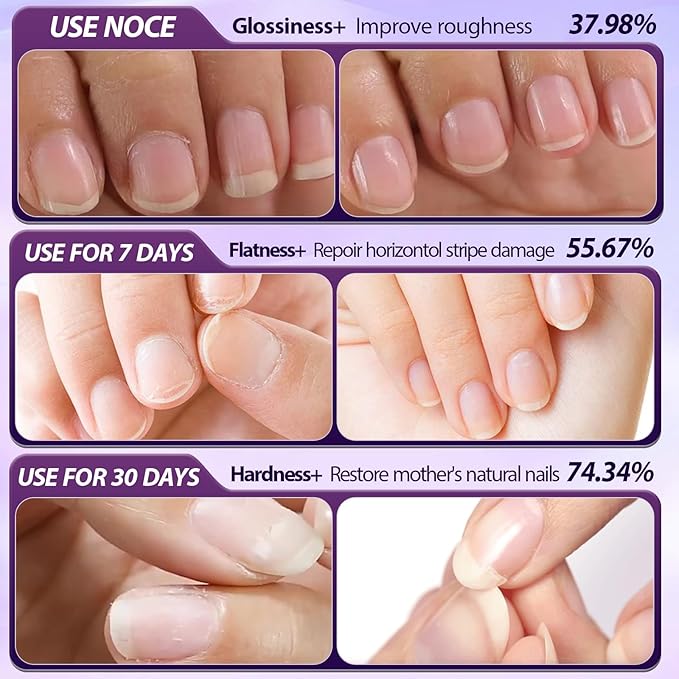 3-in-1 Cuticle Oil Pen, Cuticle Pusher Nail Oil Pen with Ceramic Tip, Nail Cuticle Remover Pen for Hangnails, Dry & Damaged Nails, Moisturize Strengthen Brighten Nails Care (3PCS)