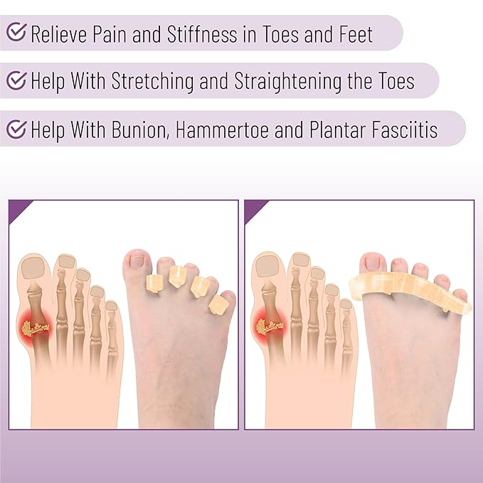 Dr. JK- ToePal Gel Toe Separator, 4 Pairs, Blush, Toe Spacers, Bunion Corrector, Christmas Gifts