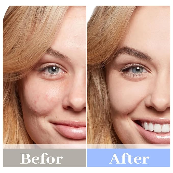 Chlorella Deep Hydrating Mask,with Bio-Collagen,Hyaluronic Acid and Chlorella | Sheet Facial Mask Skincare | Improves Hydrating,Firming,Glowing | Skin moisturizer masks,5ea