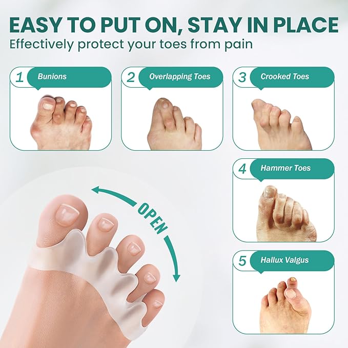 Welnove Toe Separators - 8 Pcs Toe Spacers for Women and Men - Restoring Toes to Their Original Shape - Silicone Toe Spreaders for Yoga Practice - Extra Large