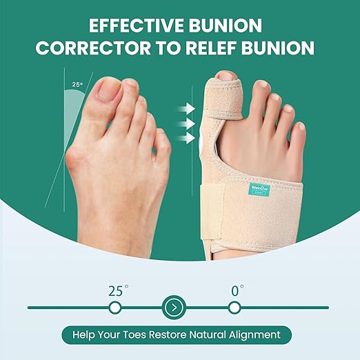 Welnove Bunion Corrector - Orthopedic Bunion Splint - Big Toe Separator Pain Relief - Bunion Correction Toe Straightener with Non-slip Strap, Day Night Support (Beige, 2 Count) - With 2 Gel Separators