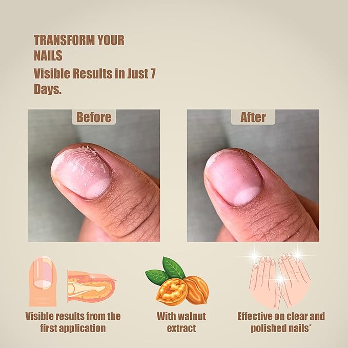 Lazonail® Nail and Cuticle Repair & Strengthening Gel | Results in 7 Days | Hydrates, Hardens and Adds Shine | Effective with or without Nail Polish | 3 ml