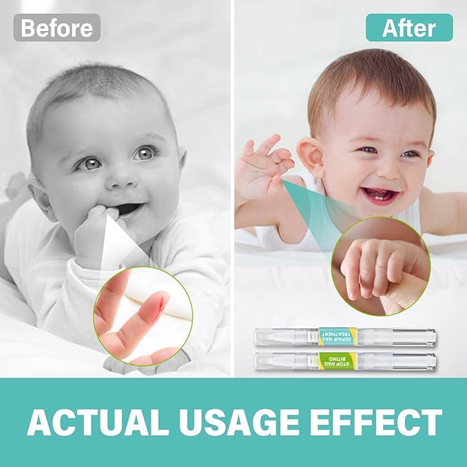 Nail Biting Prevention, 2 Pcs No Biting Treatment for Kids & Adults, Stop Nail Biting Safe