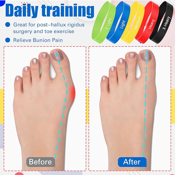 Set of 5 Toe Stretcher Bands for Bunions Correction Foot Big Toe Spacers Resistance Straightener Loop Bands with Carry Bag for Women Men Hallux Valgus Alignment Yoga Exercise(Multicolor)