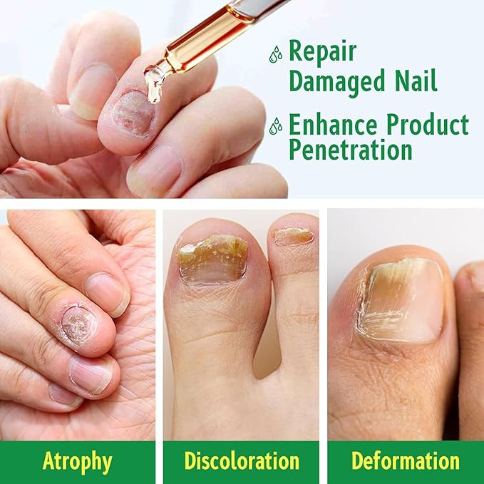 Ginger Nail Treatments, 7 Days Ginger Cuticle Care Oil for Nails for Strengthen nails & Promote Nail Growth, Natural Plant Formula（2PCS)