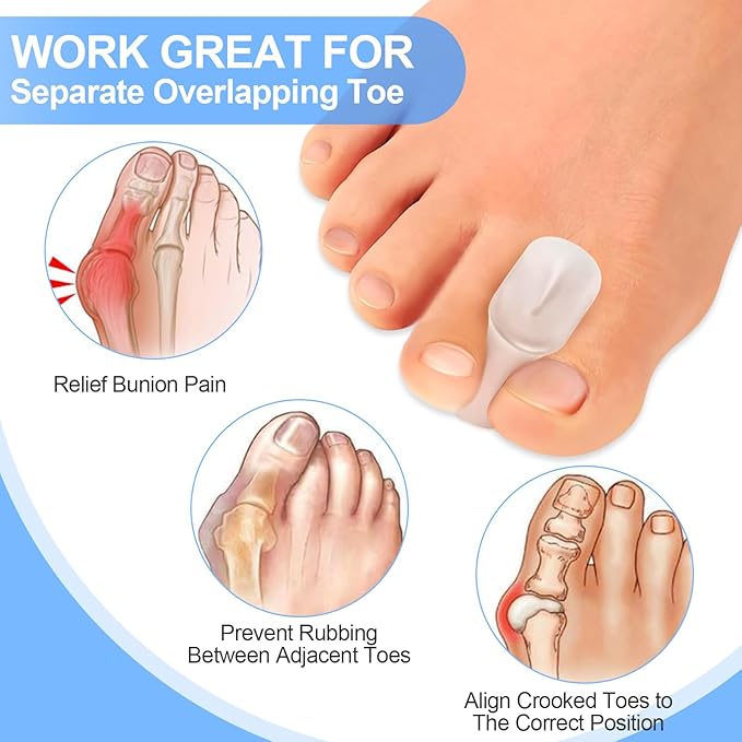 12 Pack Gel Toe Separators, Bunion Toe Spacers for Straightening Overlapping Toes, Hammertoe Corrector, Soft Silicone Bunion Pads for Women Men Toe Pain Relief (Clear)